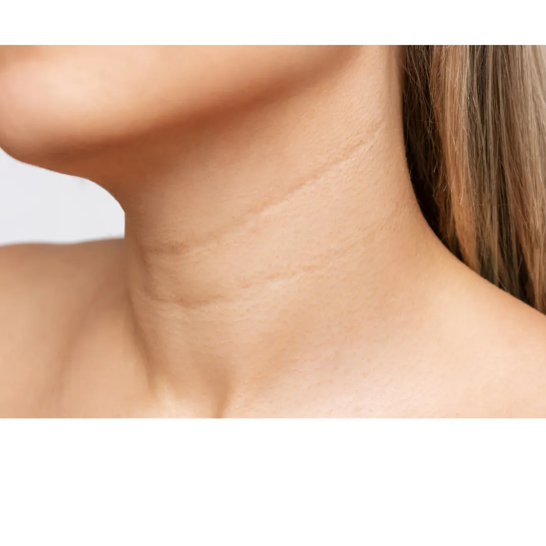 首のしわを改善する整骨院の効果的な方法とは？